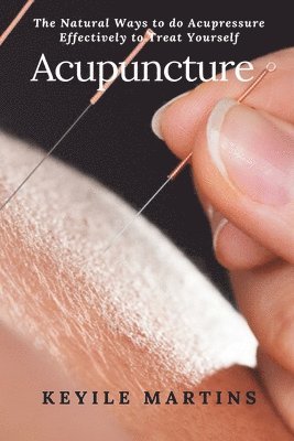 Keyile Martins - Acupuncture, Häftad