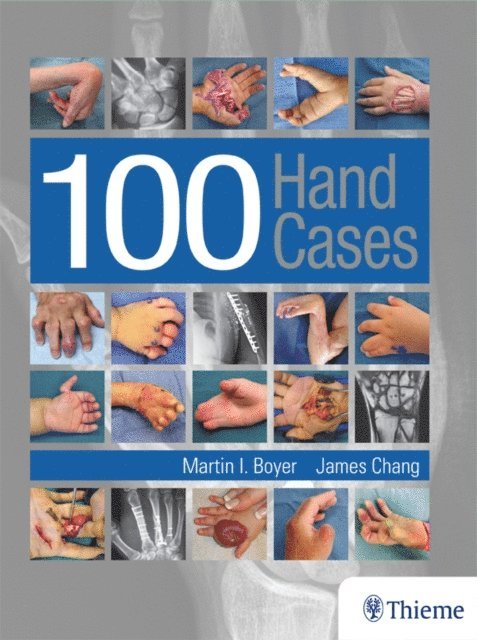 James Chang, Martin Boyer - 100 Hand Cases, E-bok
