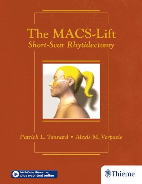 Alexis Verpaele, Patrick Tonnard - MACS-Lift, E-bok