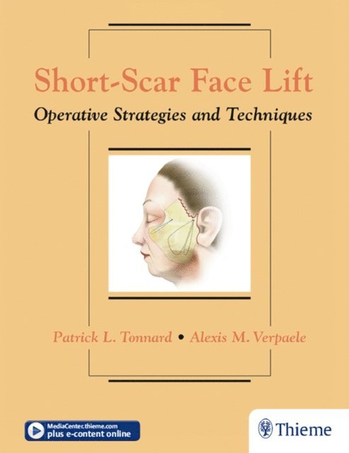 Alexis Verpaele, Patrick Tonnard - Short-Scar Face Lift, E-bok