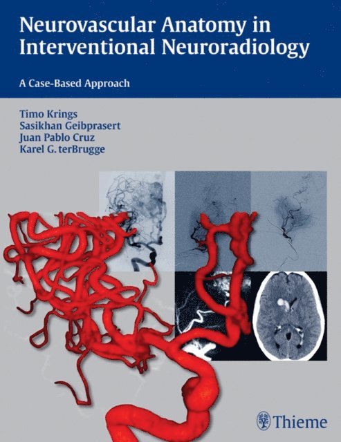 Karel ter Brugge, Juan Pablo Cruz, Sasikhan Geibprasert, Timo Krings - Neurovascular Anatomy in Interventional Neuroradiology, E-bok