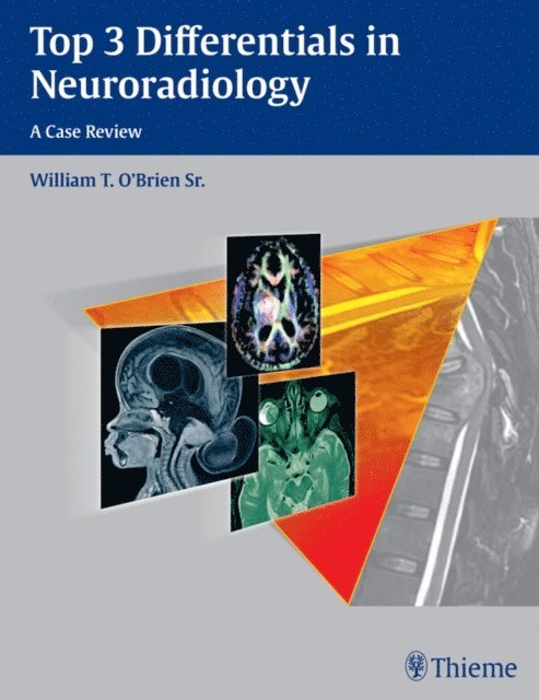 William T. O'Brien - Top 3 Differentials in Neuroradiology, E-bok