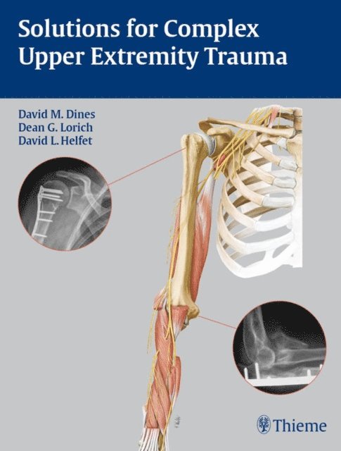 David L. Helfet, Dean G. Lorich, David M. Dines - Solutions for Complex Upper Extremity Trauma, E-bok