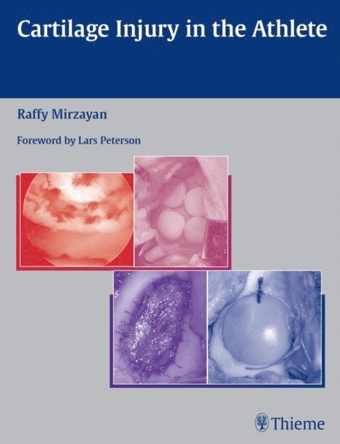 Raffy Mirzayan - Cartilage Injury in the Athlete, E-bok