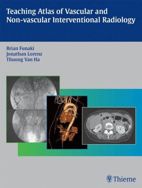 Thuong G. Van Ha, Jonathan M. Lorenz, Brian Funaki - Teaching Atlas of Vascular and Non-vascular Interventional Radiology, E-bok