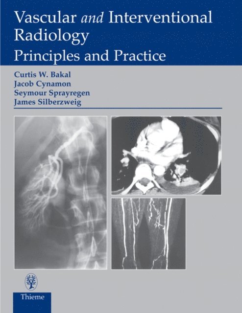 Seymour Sprayregen, Jacob Cynamon, James E. Silberzweig, Curtis W. Bakal - Vascular and Interventional Radiology, E-bok