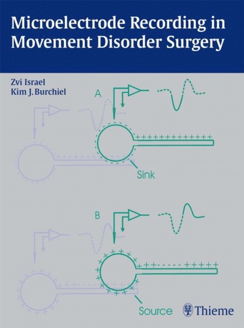 Kim J. Burchiel, Zvi Israel - Microelectrode Recording in Movement Disorder Surgery, E-bok