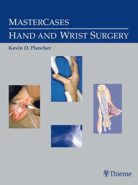 Kevin D. Plancher - MasterCases in Hand and Wrist Surgery, E-bok