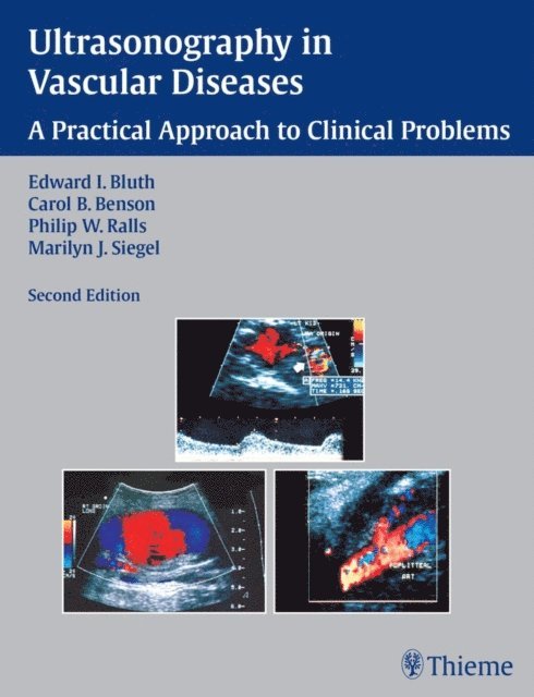 Marilyn J. Siegel, Philip W. Ralls, Carol B. Benson, Edward I. Bluth - Ultrasonography in Vascular Diseases, E-bok
