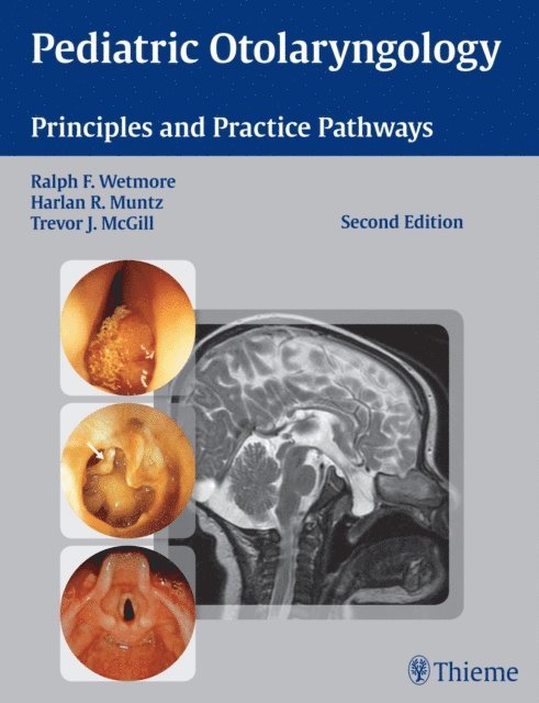 Trevor J. McGill, Harlan R. Muntz, Ralph F. Wetmore - Pediatric Otolaryngology, E-bok