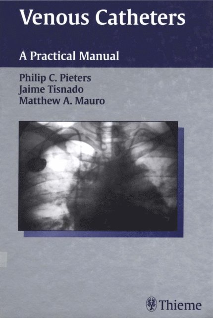 Matthew A. Mauro, Jaime Tisnado, Philip C. Pieters - Venous Catheters, E-bok