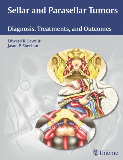 Jason P Sheehan, Edward R. Laws - Sellar and Parasellar Tumors, E-bok