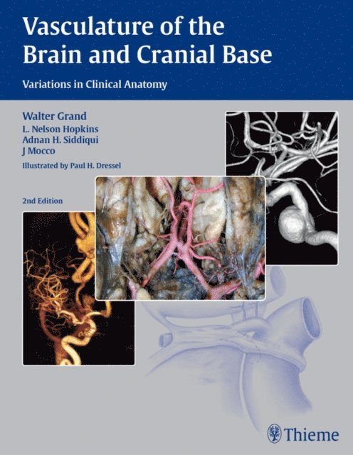 J Mocco, Adnan Hussain Siddiqui, L. Nelson Hopkins, Walter Grand - Vasculature of the Brain and Cranial Base, E-bok