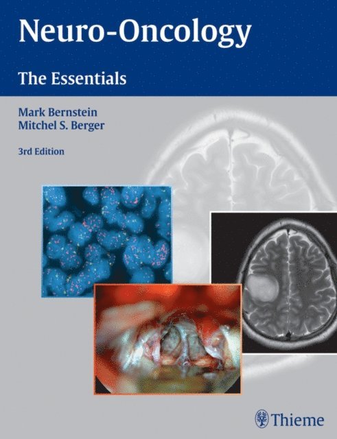 Mitchel S. Berger, Mark Bernstein - Neuro-Oncology: The Essentials, E-bok