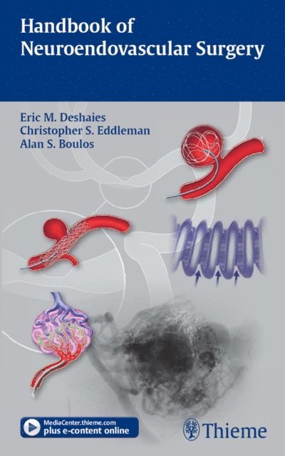 Alan S. Boulos, Christopher S. Eddleman, Eric M. Deshaies - Handbook of Neuroendovascular Surgery, E-bok