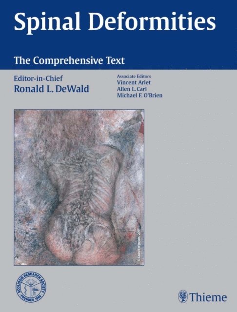 Ronald L. DeWald - Spinal Deformities: The Comprehensive Text, E-bok