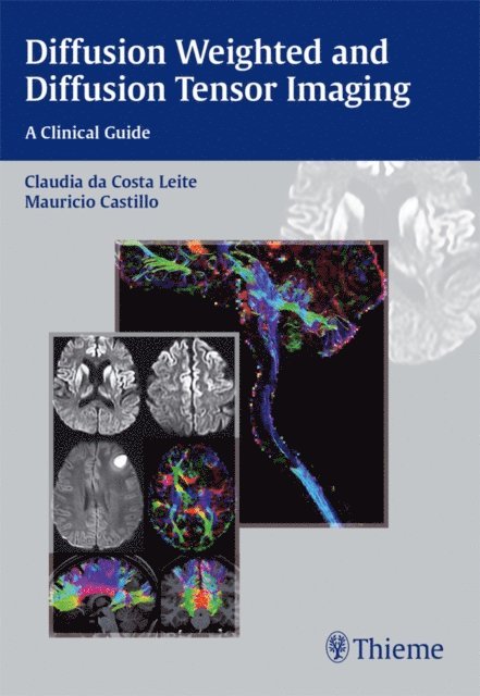 Mauricio Castillo, Claudia Leite - Diffusion Weighted and Diffusion Tensor Imaging, E-bok