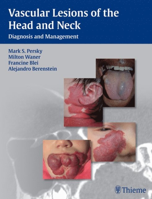 Alejandro Berenstein, Francine Blei, Milton Waner, Mark S. Persky - Vascular Lesions of the Head and Neck, E-bok