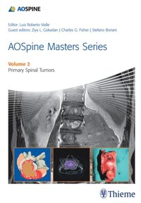 AOSpine Masters Series, Volume 2: Primary Spinal Tumors