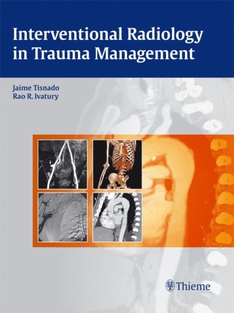 Rao R Ivatury, Jaime Tisnado - Interventional Radiology in Trauma Management, E-bok