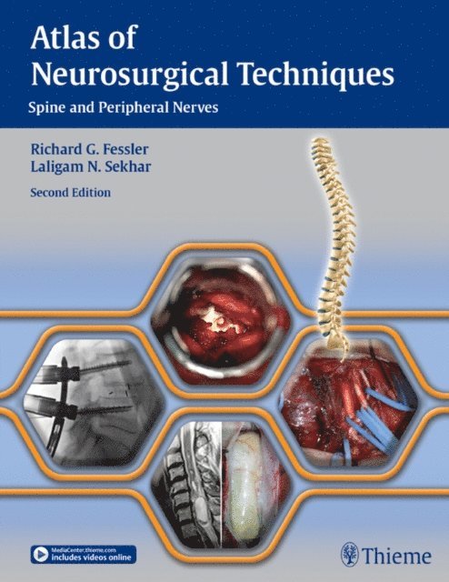 Laligam N. Sekhar, Richard Glenn Fessler - Atlas of Neurosurgical Techniques, E-bok