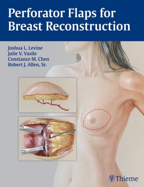 Robert J. Allen, Connie Chen, Julie V. Vasile, Joshua L. Levine - Perforator Flaps for Breast Reconstruction, E-bok