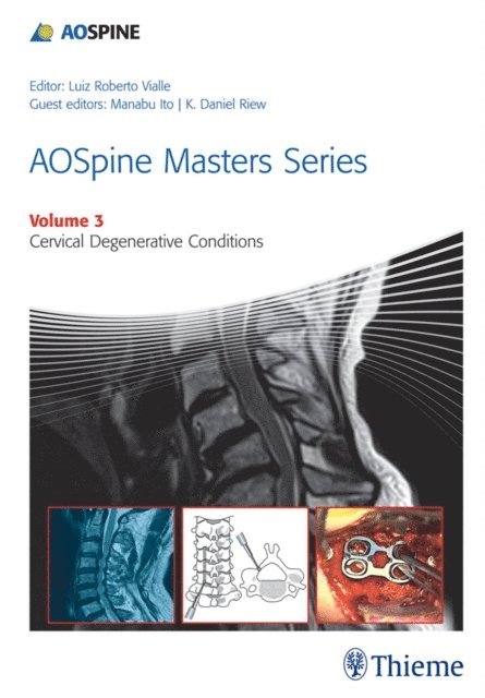 Manabu Ito, K. Daniel Riew - AOSpine Masters Series, Volume 3: Cervical Degenerative Conditions, E-bok