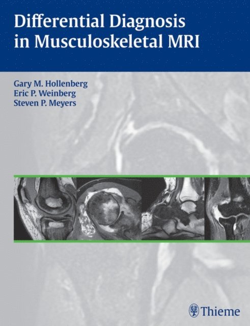 Steven P. Meyers, Eric P. Weinberg, Gary M. Hollenberg - Differential Diagnosis in Musculoskeletal MRI, E-bok
