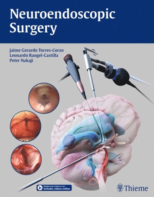 Peter Nakaji, Leonardo Rangel-Castilla, Jaime Torres-Corzo - Neuroendoscopic Surgery, E-bok