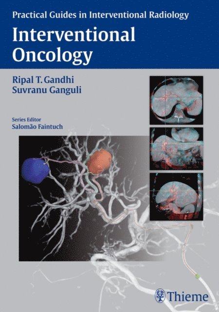 Suvranu Ganguli, Ripal Gandhi - Interventional Oncology, E-bok. Tillgänglighet: Lägg i varukorg