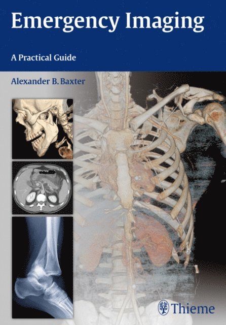 Alexander Baxter - Emergency Imaging, E-bok
