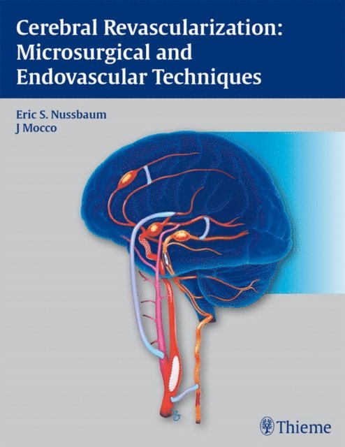 J Mocco, Eric Nussbaum - Cerebral Revascularization: Microsurgical and Endovascular Techniques, E-bok
