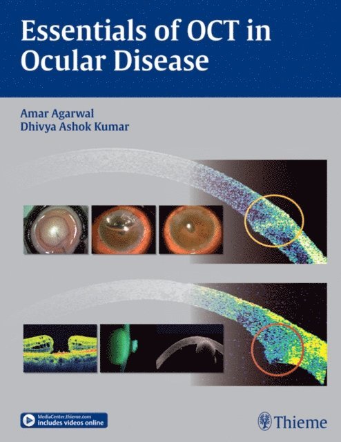 Dhivya Ashok Kumar, Amar Agarwal - Essentials of OCT in Ocular Disease, E-bok