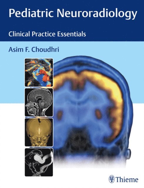 Asim F. Choudhri - Pediatric Neuroradiology, E-bok. Tillgänglighet: Lägg i varukorg