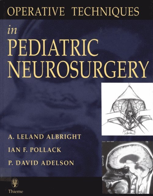 P. David Adelson, Ian F. Pollack, A. Leland Albright - Operative Techniques in Pediatric Neurosurgery, E-bok