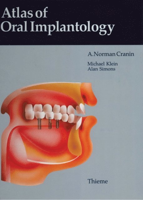 Michael Klein, A. Norman Cranin - Atlas of Oral Implantology, E-bok
