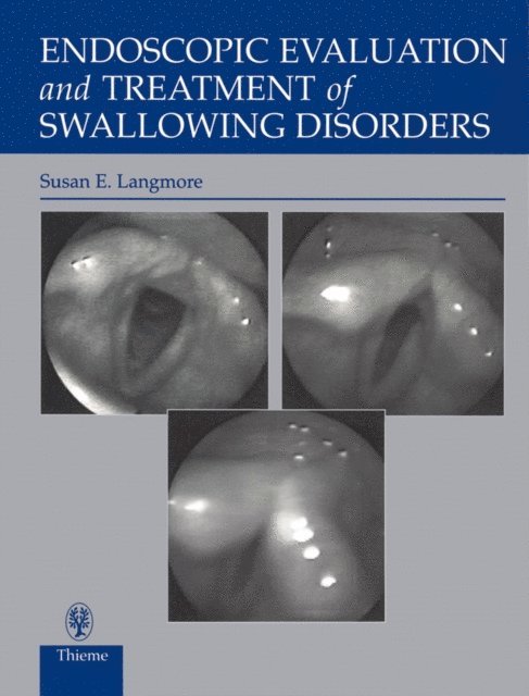 Susan Langmore - Endoscopic Evaluation and Treatment of Swallowing Disorders, E-bok