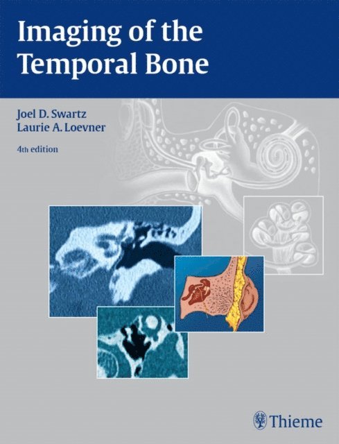 Laurie A. Loevner, Joel D. Swartz - Imaging of the Temporal Bone, E-bok