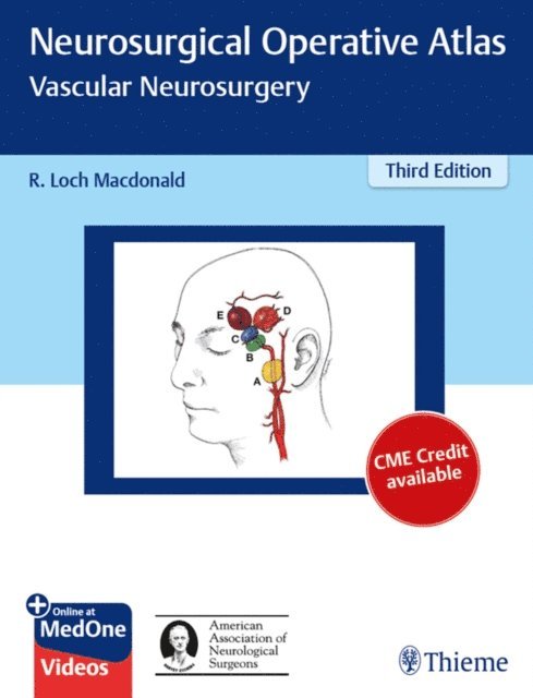 R. Loch Macdonald - Neurosurgical Operative Atlas: Vascular Neurosurgery, E-bok