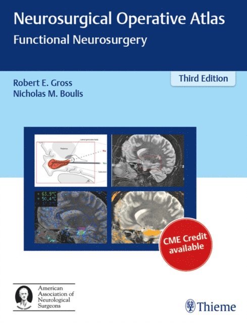 Nicholas M. Boulis, Robert E. Gross - Neurosurgical Operative Atlas, E-bok. Tillgänglighet: Lägg i varukorg
