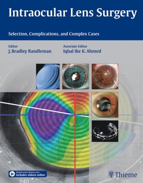 Iqbal Ike K Ahmed, Bradley Randleman - Intraocular Lens Surgery, E-bok. Tillgänglighet: Lägg i varukorg