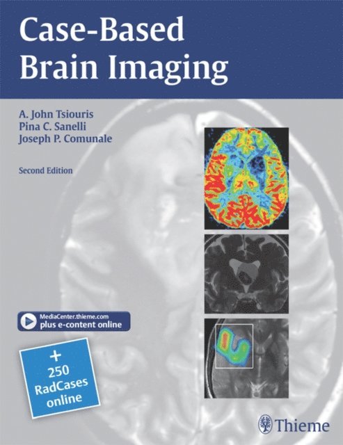 Joseph Comunale, Pina C. Sanelli, A. John Tsiouris - Case-Based Brain Imaging, E-bok