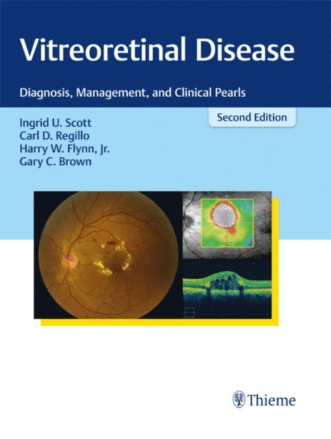 Gary C. Brown, Jr. Harry W. Flynn, Carl D. Regillo, Ingrid U. Scott - Vitreoretinal Disease, E-bok