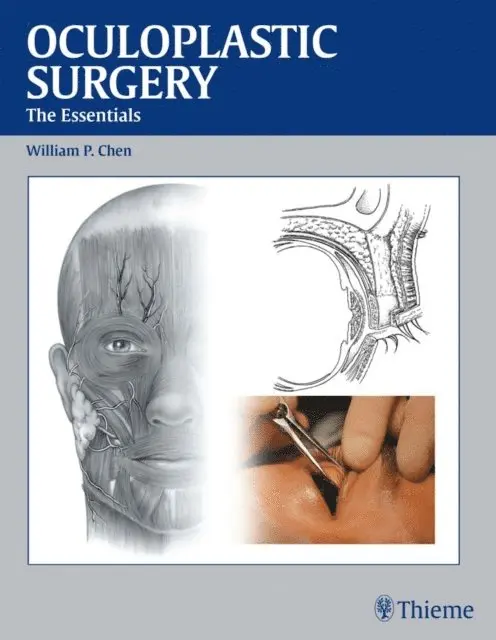 William Pai-Dei Chen - Oculoplastic Surgery, E-bok. Tillgänglighet: Lägg i varukorg