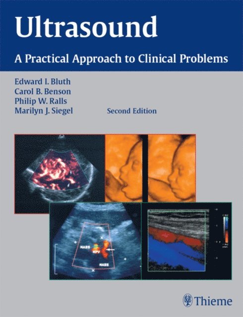 Marilyn J. Siegel, Philip W. Ralls, Carol B. Benson, Edward I. Bluth - Ultrasound, E-bok