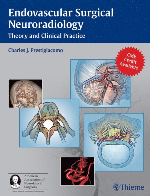 Charles J. Prestigiacomo - Endovascular Surgical Neuroradiology, E-bok. Tillgänglighet: Lägg i varukorg