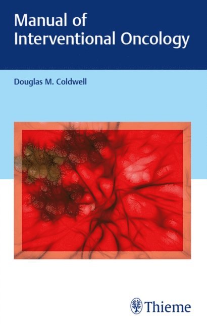 Douglas M. Coldwell - Manual of Interventional Oncology, E-bok. Tillgänglighet: Lägg i varukorg