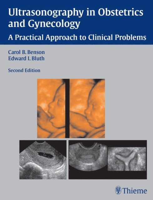 Edward I. Bluth, Carol B. Benson - Ultrasonography in Obstetrics and Gynecology, E-bok
