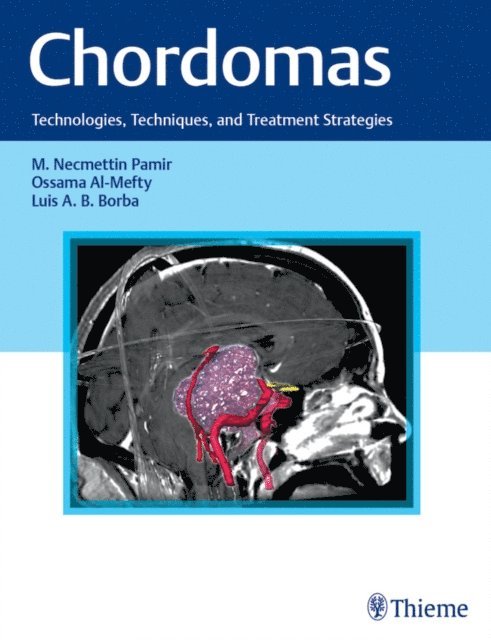 Luis Borba, Ossama Al-Mefty, M. Necmettin Pamir - Chordomas, E-bok
