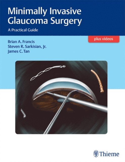 James C. Tan, Steven Sarkisian, Brian Francis - Minimally Invasive Glaucoma Surgery, E-bok